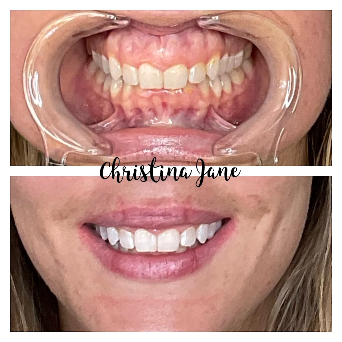 ⭐ 159 Best Teeth Whitening Services In United States 5 Star Rated