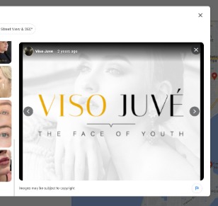 Viso Juve