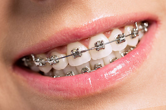 McKinney Orthodontics