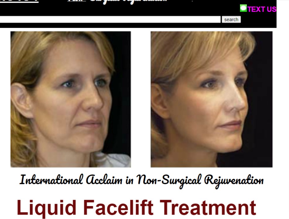Wrinkle Fillers Medical Spa