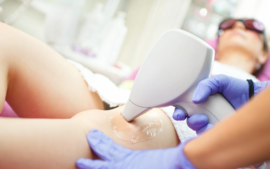 Electrolysis Vs Laser Hair Removal  Benefits Cost And Side Effects