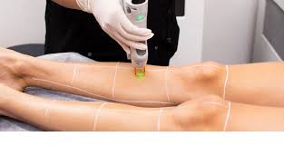 Charlotte Skin and Laser reviews