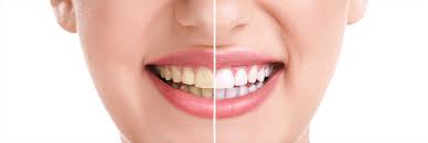 Toothbar