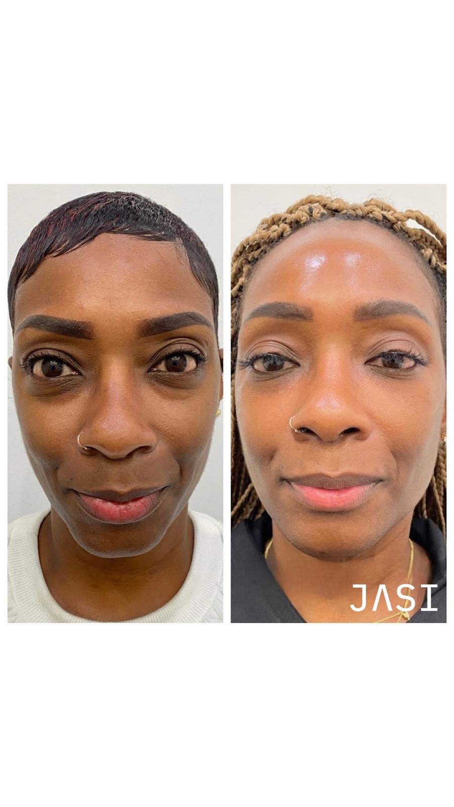 JASI Skin + Wellness Med Spa