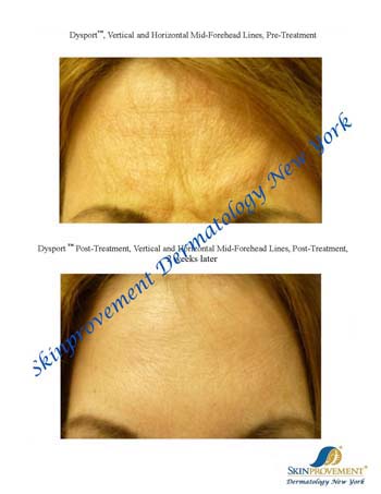 SkinProvement Dermatology New York