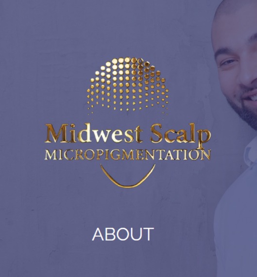 Scalp Micro Midwest (+Microblading)