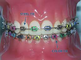 Denise Doan, DDS, MMSc-Kifer Dental Specialists - Orthodontics