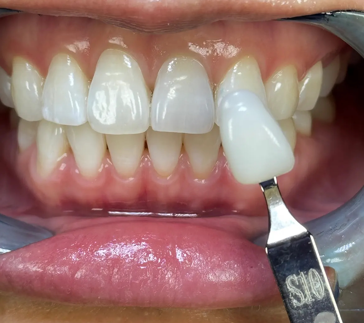 Aviator Dental Hygiene