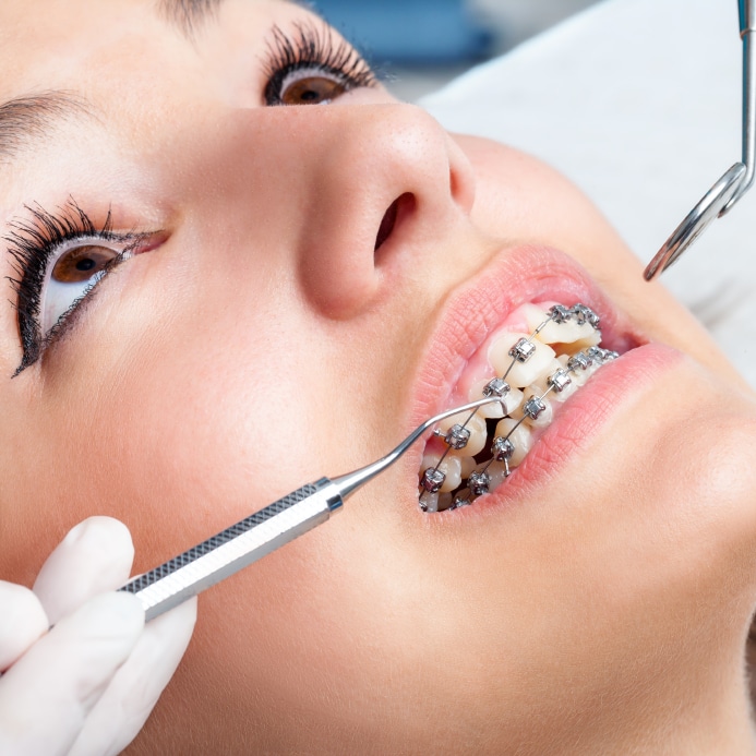 CT Braces - Bridgeport Orthodontics reviews