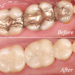 Washington State Prosthodontics