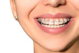 Flores Orthodontics