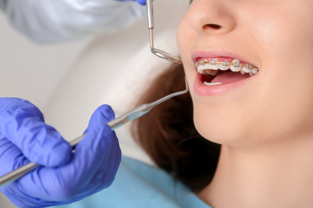 Sexson Orthodontics, Ltd.