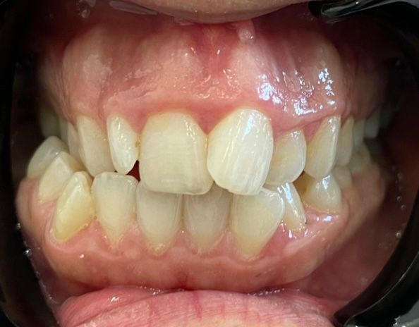 Walk In Family Dentistry