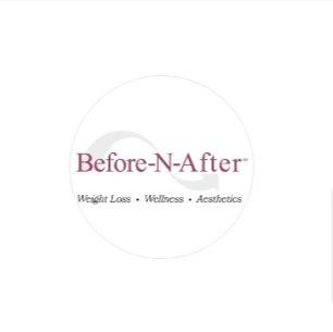 Before-N-After