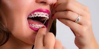 Minars Orthodontics