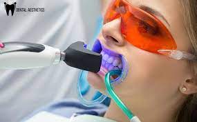 Mitchell Dental Spa