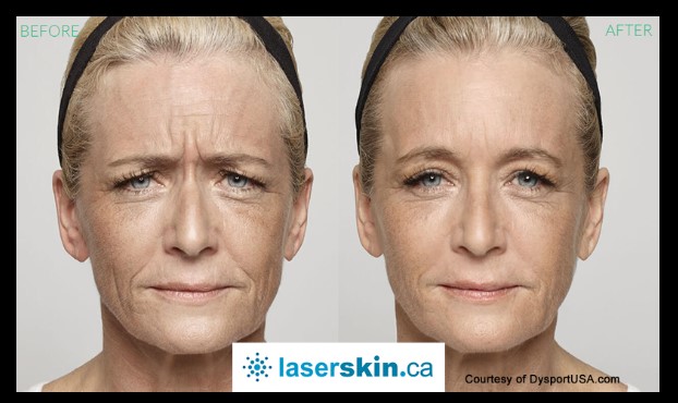 Laserskin.ca