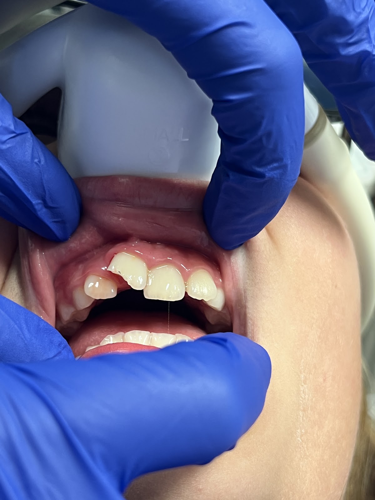 Canyon Dental | Dr. Joe Schmidt | Lewiston and Clarkston
