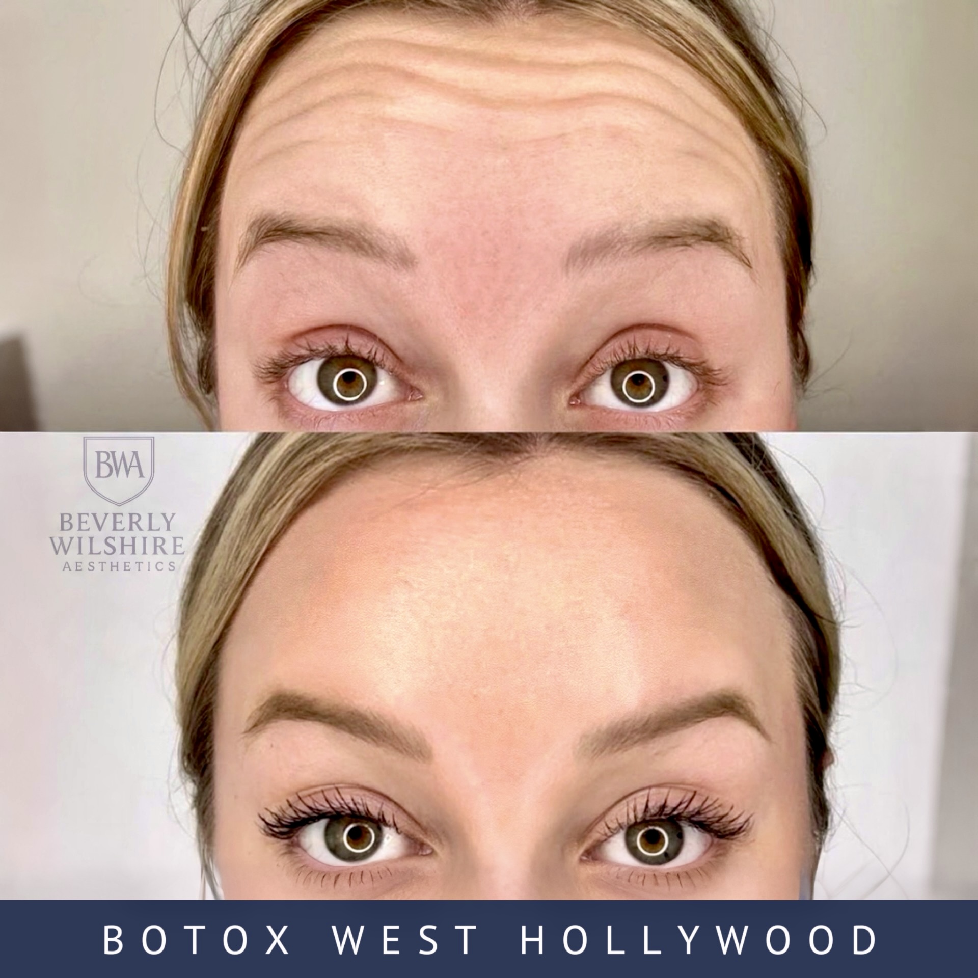 Beverly Wilshire Aesthetics Beverly Hills Medical Spa