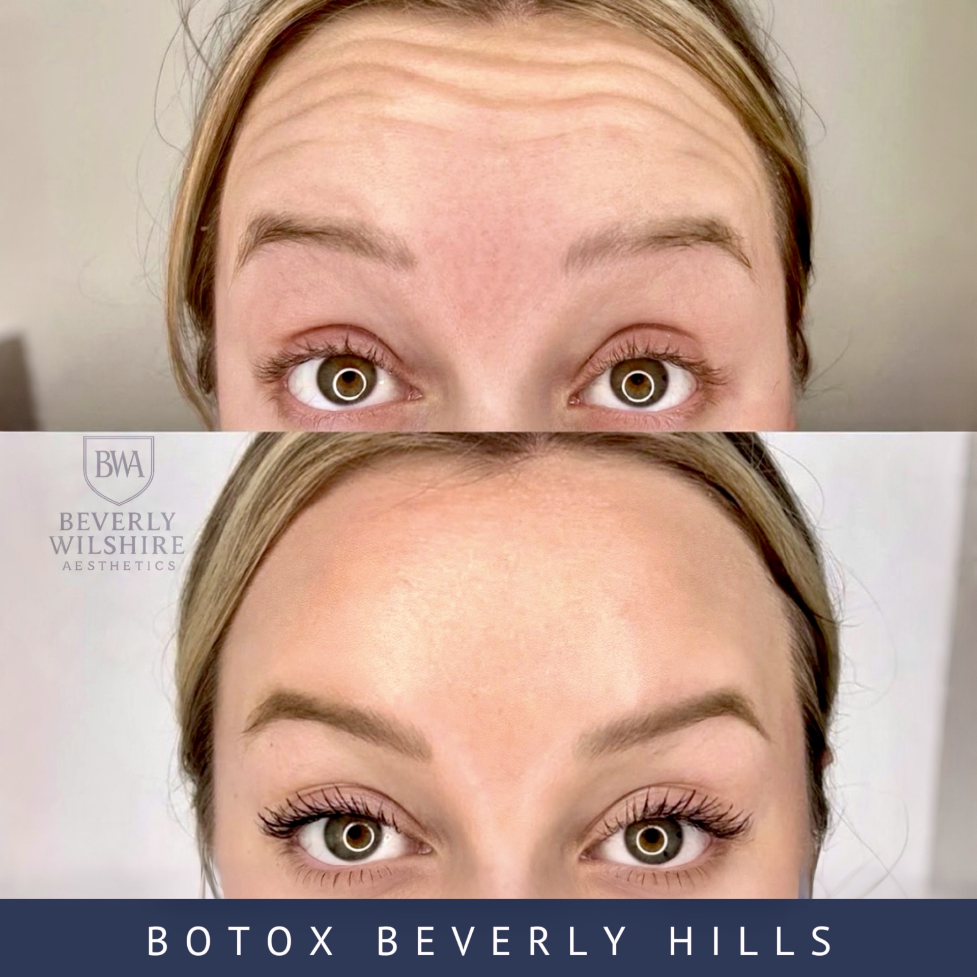 Beverly Wilshire Aesthetics Beverly Hills Medical Spa